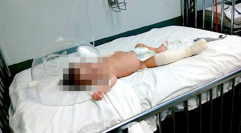 bebe lesionada 24 jun Investiga PGJE muerte cerebral de bebé por lesiones en SJC