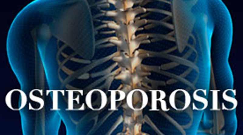 Hoy, Día Mundial de la Osteoporosis Hoy, Día Mundial de la Osteoporosis