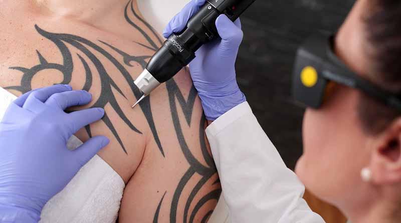 Acuerdo de propiedad intelectual recomendable en tatuajes Acuerdo de propiedad intelectual recomendable en tatuajes