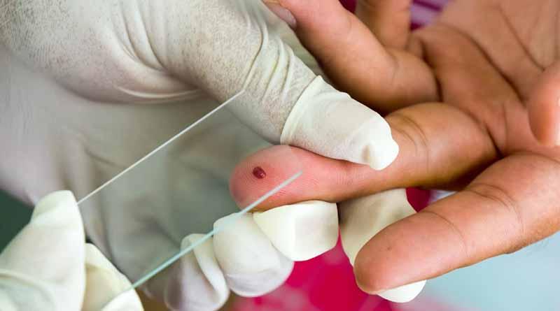 Busca secretaría de Salud Certificar a BCS Libre de Paludismo Busca Secretaría de Salud Certificar a BCS Libre de Paludismo