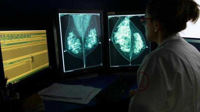 cancermama Tecnología 3D sería útil para reconstruir senos en mujeres con cáncer