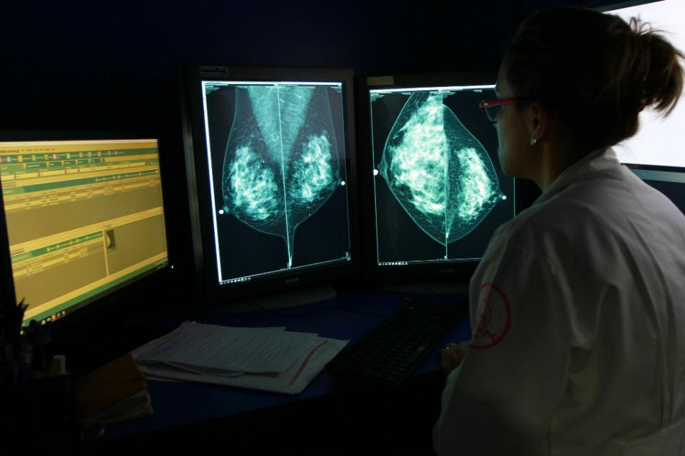 cancermama Tecnología 3D sería útil para reconstruir senos en mujeres con cáncer