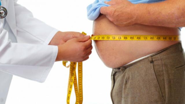 obesidad2 Factor psicológico, determinante para enfrentar sobrepeso y obesidad