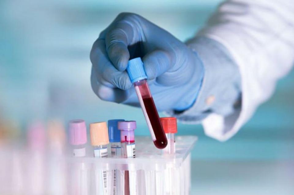 pruebasangre2 Avanzan en el primer análisis de sangre comercializable para el cáncer de mama