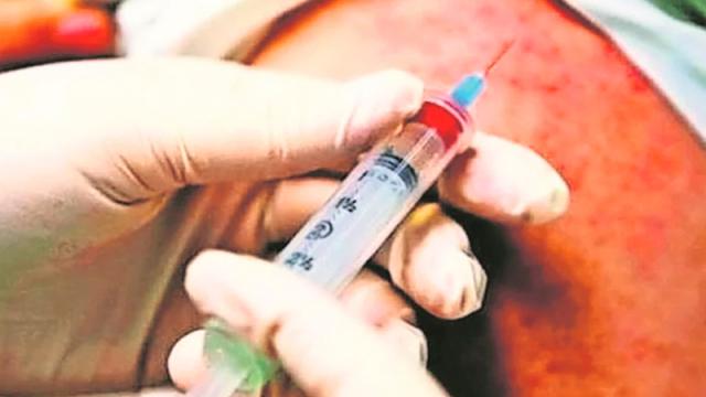 ras pandemia de Covid-19, posible brote de sarampión: expertos SALUD-CORONAVIRUS